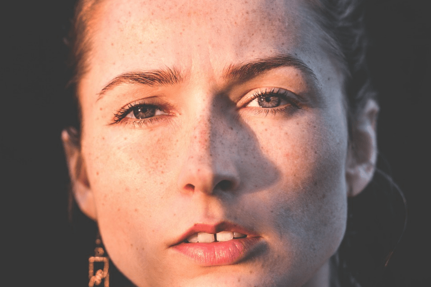 woman-face-freckles-fashion-girl