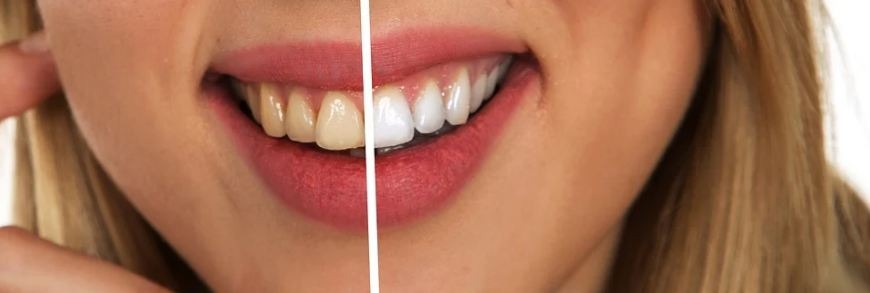 Grinding or clenching teeth could cause toothaches.