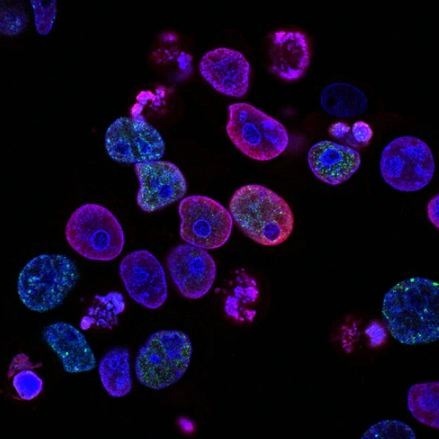 Exfoliating Boosts Cell Turnover