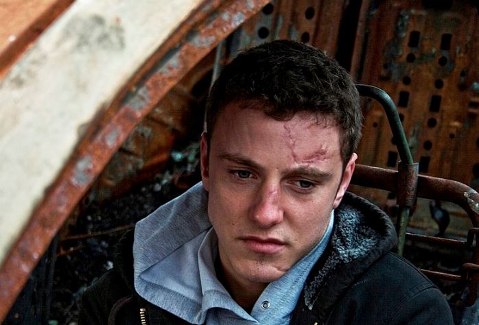 a man with visible facial scars