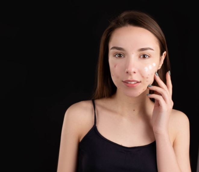 a woman with a cream for her pimples