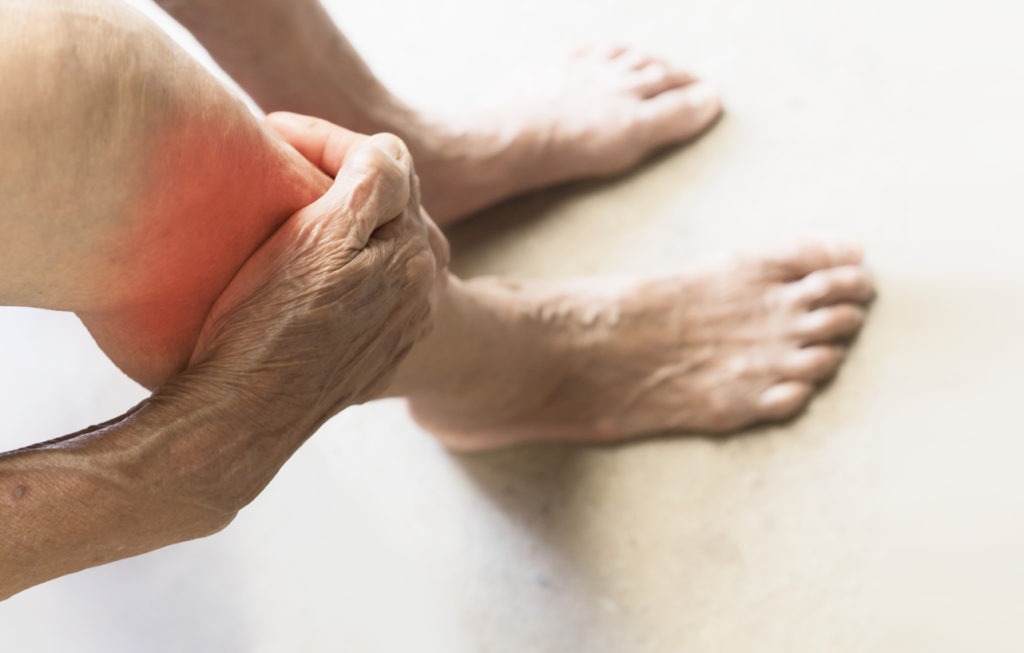 person holding their inflamed leg