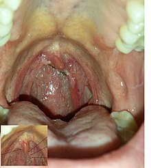 The Importance of Treatment