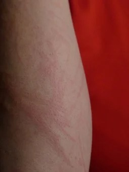 arm