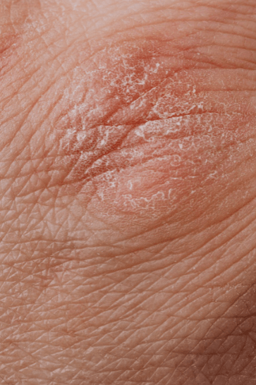 Possible Complications