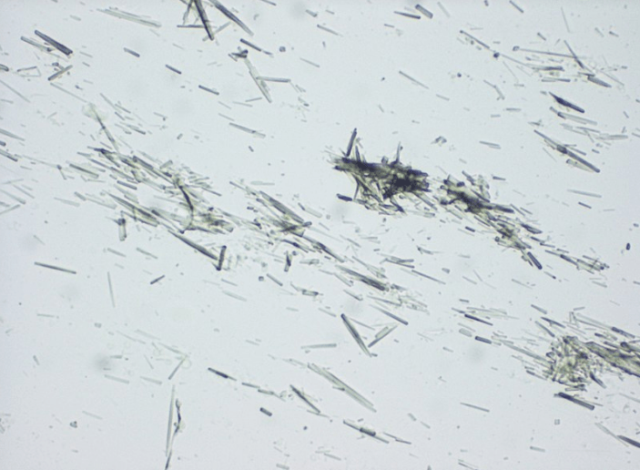 Light microscopy of a touch preparation of a gout tophus