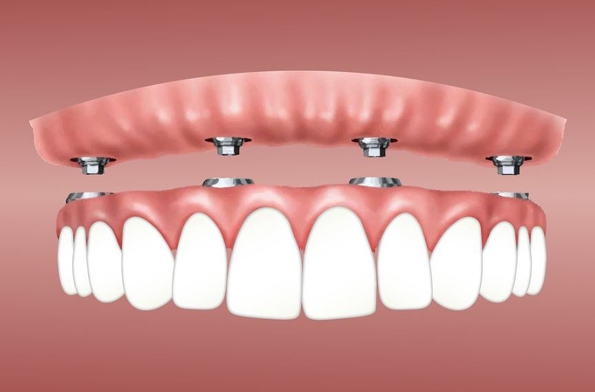 Gum disease causes excruciating toothache.