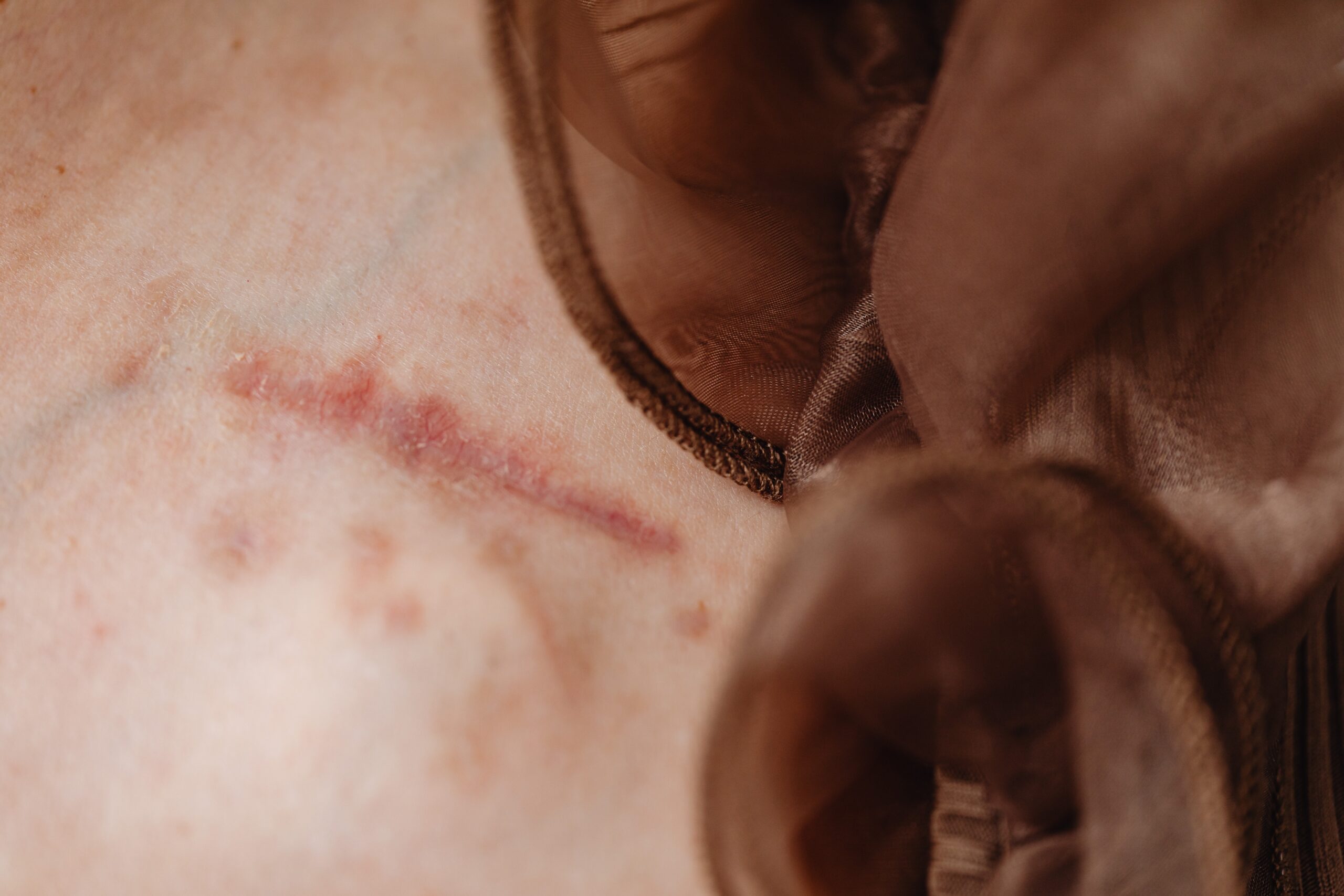 a close-up shot of a scar