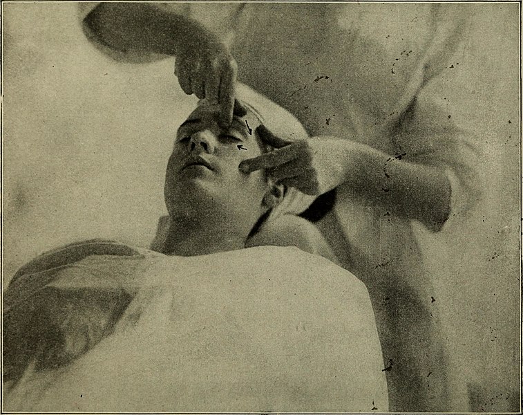 A 1914 photograph for Emily Lloyd's dermatology book detailing the benefits of massage for all skin types; the c. 1870 text reads, "Extremely sensitive skins sometimes become irritated under even the lightest treatment but these are exceptions to the rule."
